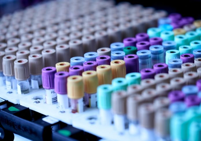 analisis-Ru4V52P8rQbT6nwYtV8WlJJ-758x531@abc