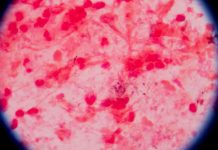 UNAM patentan proceso de bacteria para biotransformar metales tóxicos