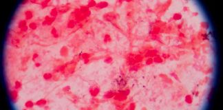 UNAM patentan proceso de bacteria para biotransformar metales tóxicos