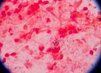 UNAM patentan proceso de bacteria para biotransformar metales tóxicos