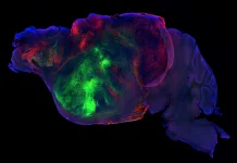 Científicos injertan neuronas humanas en ratones sin corteza cerebral y recuperan sus capacidades