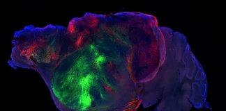 Científicos injertan neuronas humanas en ratones sin corteza cerebral y recuperan sus capacidades