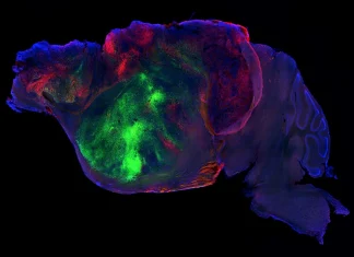 Científicos injertan neuronas humanas en ratones sin corteza cerebral y recuperan sus capacidades